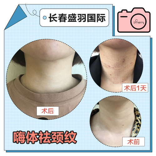 盛羽医美